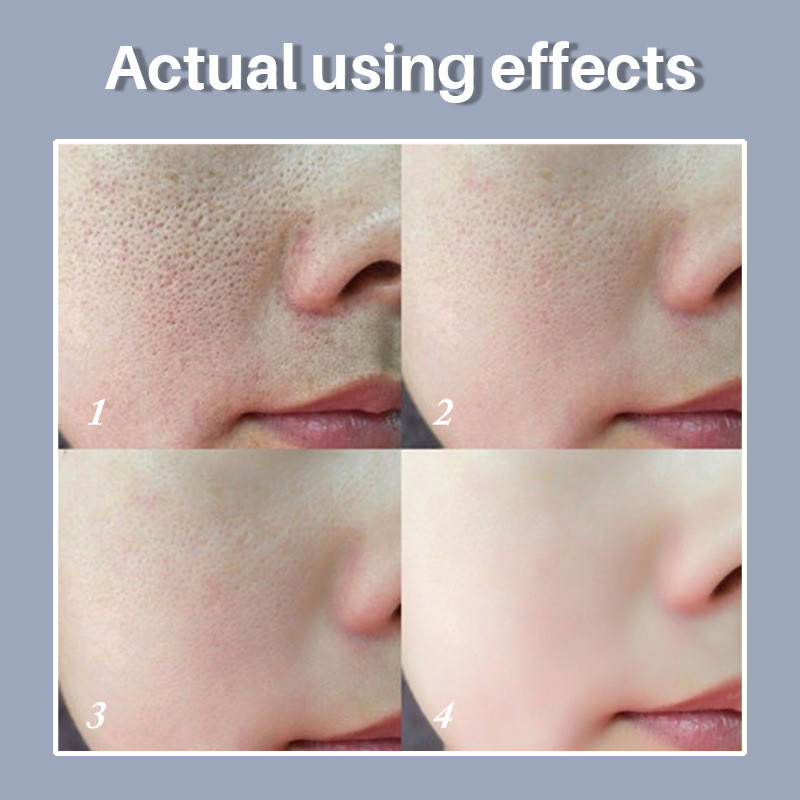 (🔥CHRISTMAS HOT SALE-48% OFF)2021 New Magical Perfecting Base Face Primer Under Foundation-BUY 2 GET 1 FREE TODAY!