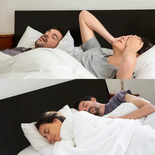 Airing: The first hoseless, maskless, micro-CPAP Anti Snoring