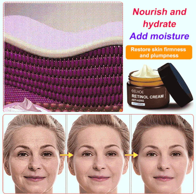 Last Day Promotion 75% OFF -🔥 Retinol Anti Aging Wrinkle Removal Skin Firming Cream