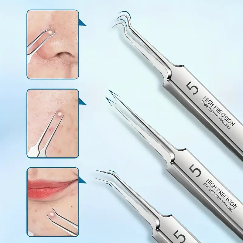 💥LAST DAY SALE 49% OFF💥Professional Facial Blackhead Remover Tweezers