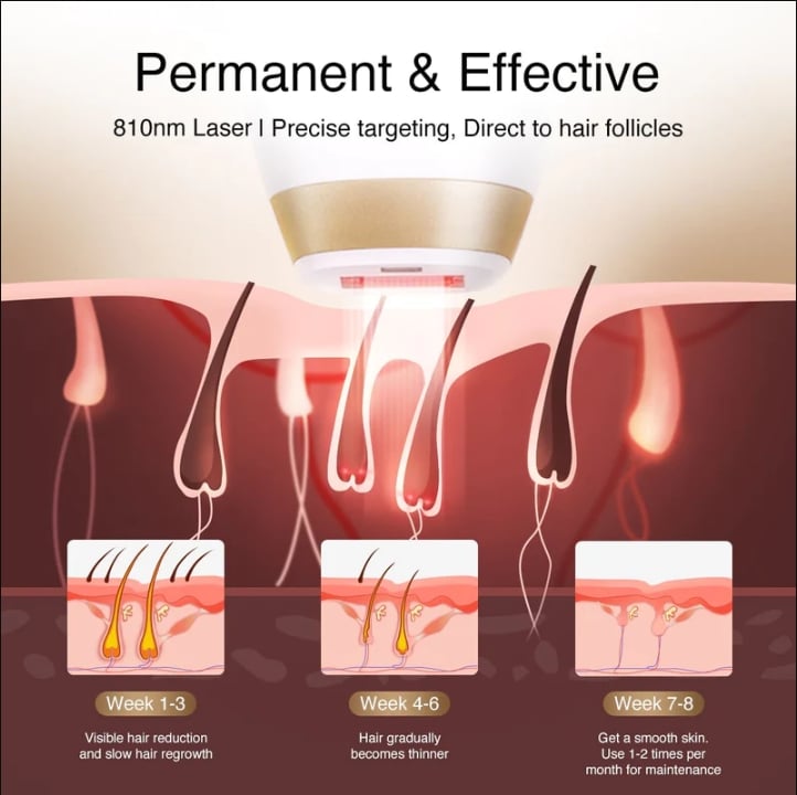 Laser Hair Removal, Up to 21J, 810nm