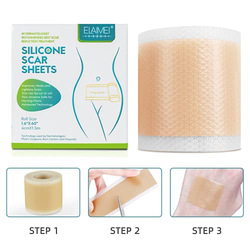 Medical Soft Silicone Gel Tape for Scar Removal