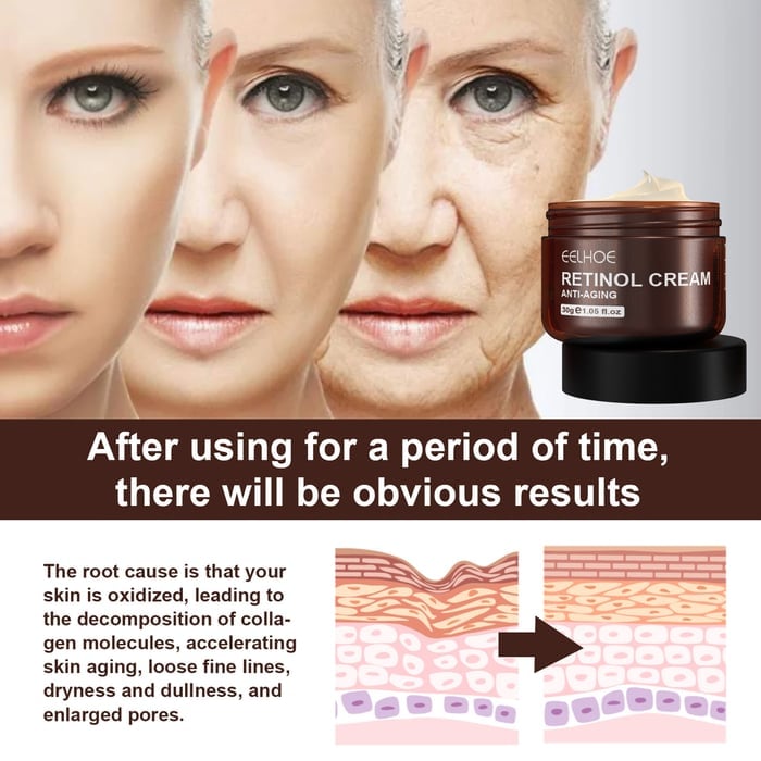 Last Day Promotion 75% OFF -🔥 Retinol Anti Aging Wrinkle Removal Skin Firming Cream