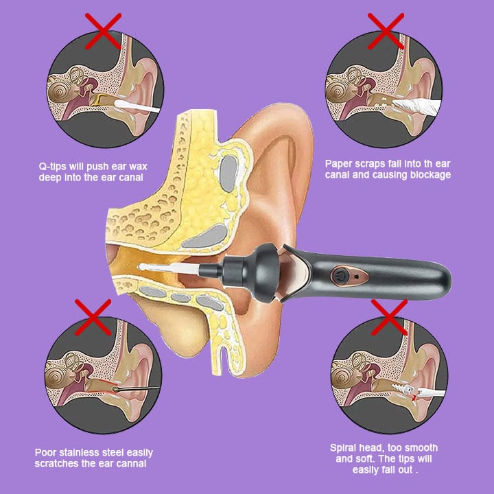 (🔥Mother's Day Sale🔥)Painless ear cleaning for the whole family-Buy 2 Get Free Shipping