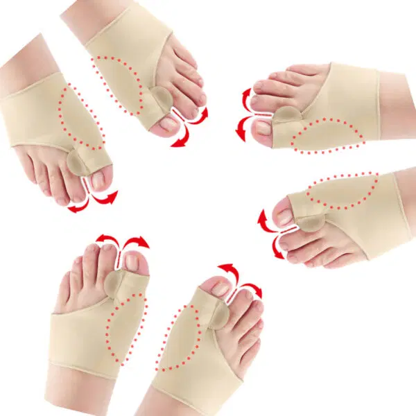 Orthopedic Bunion Corrector with Toe Separator
