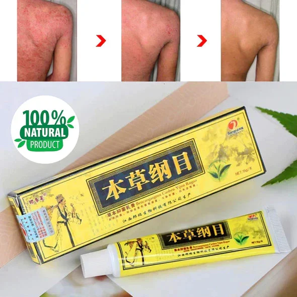🔥Hot Sale Now-SAVE 50% OFF🔥Latest👨‍⚕Original Advanced Psoriasis & Eczema Natural Herbal Cream