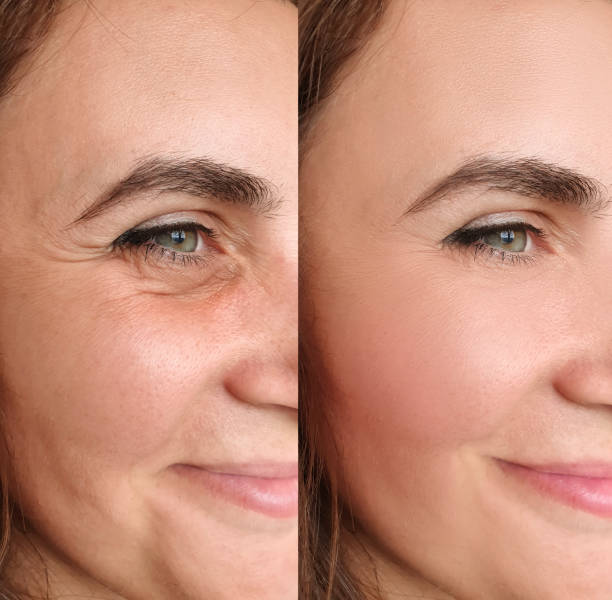 Multi-Spectral Facial Rejuvenation Device