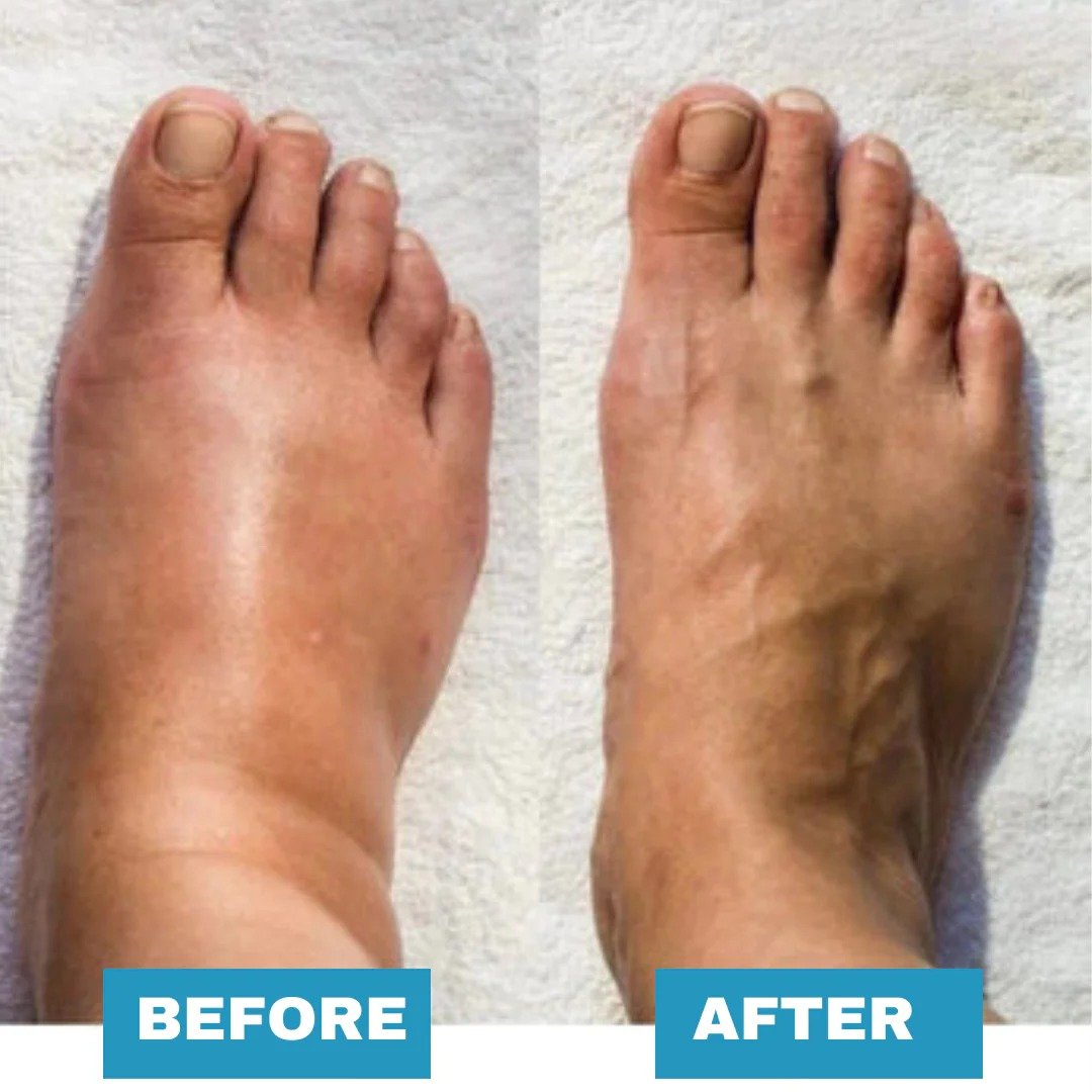 🎉Mother's day Sale OFF 60%🔥 Foot Massager - For Lasting Foot Pain Relief