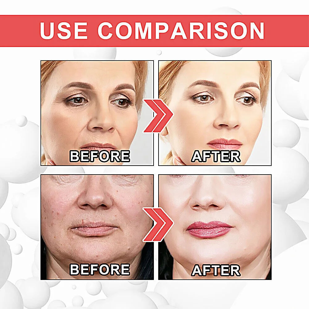Summer 50% Off🎁 Collagen Anti-Wrinkle Cream